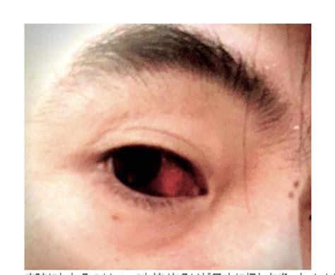 元「うたのおにいさん」今井ゆうぞうさんが脳内出血で急逝 生前最後のブログには“目の異常な充血”（1/2 ページ） - ねとらぼ
