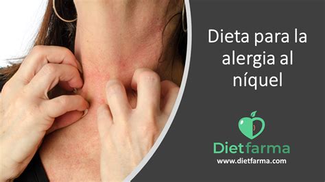 Remédio Para Alergia A Níquel