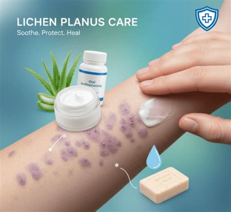 lichen planus care  korea koreahealthglobal