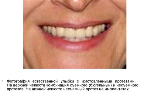 Дентальная имплантология. Хирургический этап - online presentation