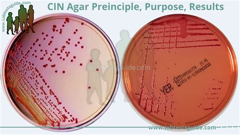 CIN Agar: Composition, Preparation, Principle, Interpretation, and ...