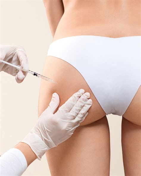 sculptra buttocks enhancement renue medical spa