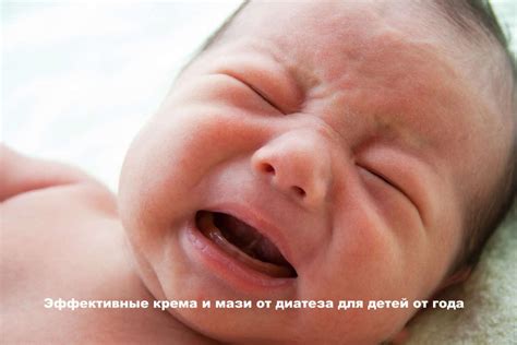Мази от диатеза для детей: до и после года, какие выбрать?