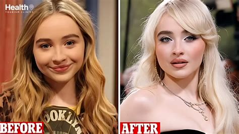 Sabrina Carpenter Antes E Depois - Sabrina Carpenter’s Plastic Surgery Journey: Surprising Outcome