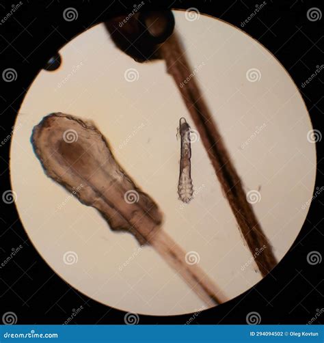 Demodex Mite From A Microscope View. The Parasite Causing A Skin