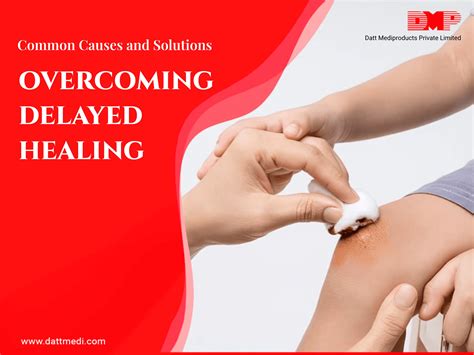 The strange reason your train latest status is showing delayed 5