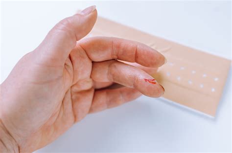 How to treat a deep skin cut