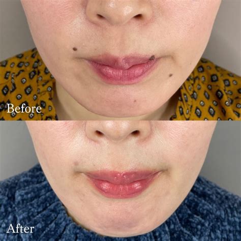 beauty journey