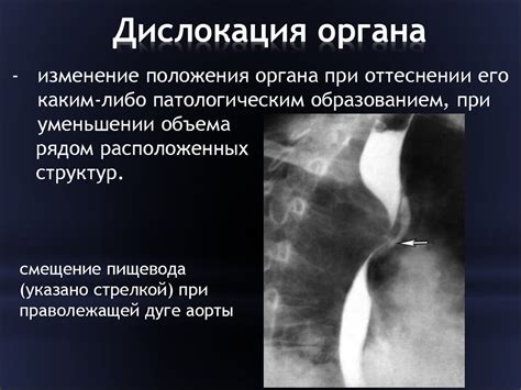 Лучевая диагностика заболеваний желудочно-кишечного тракта ...