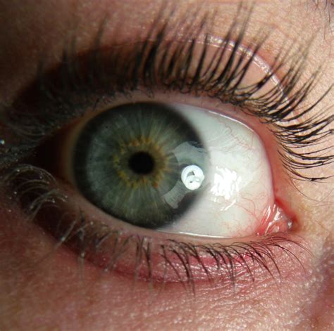 yellow gold central heterochromia dark limbal ring grey eyes | Gray ...