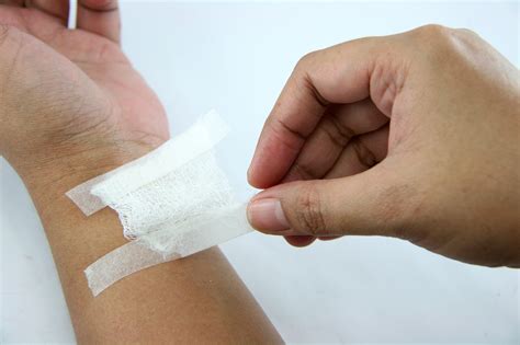 Как пользоваться спиртом для втирания: 5 шагов