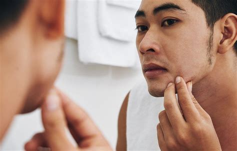 common skin issues  men dtap clinic