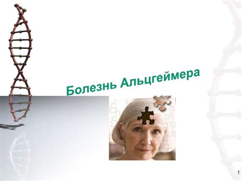 Болезнь Альцгеймера - презентация онлайн