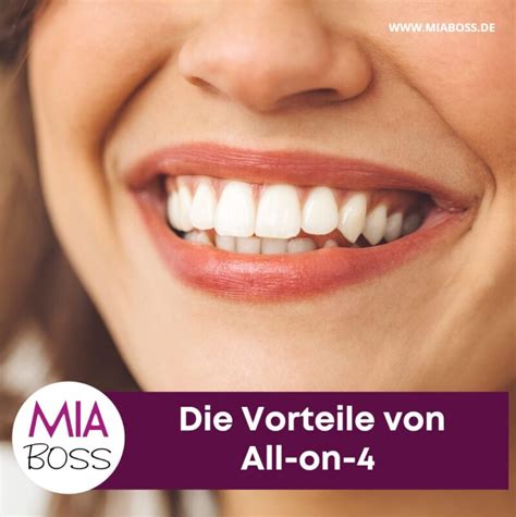 All-on-4: Die Revolution in der Zahnmedizin | Vorteile