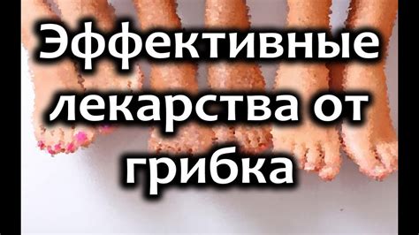 Лекарство от грибка ногтей на ногах - ТОП средств - YouTube