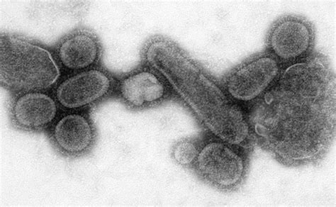 “Томуугийн А хүрээний H3N2 вирус уушгины хатгалгаа үүсгэхээс гадна ...