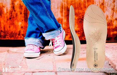 Как выбрать ортопедические стельки, что учесть при покупке