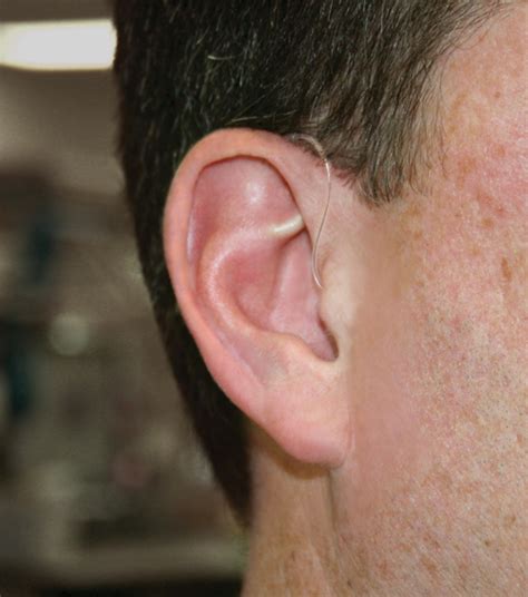 Hearing Aids – Halton Hearing Centre