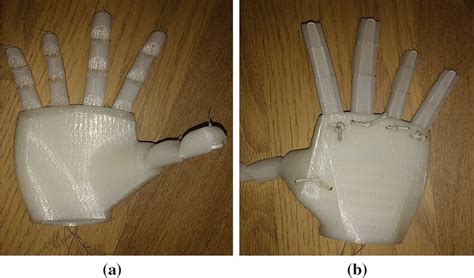 a, b Three-dimensional printed model of prosthetic arm | Download ...