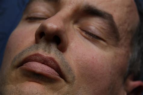 Is Sedation Dentistry Right for You? - Your Dental Health Resource