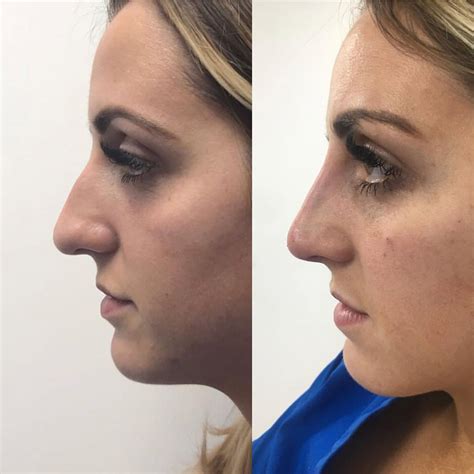 Nose Contouring Makeup You | Saubhaya Makeup