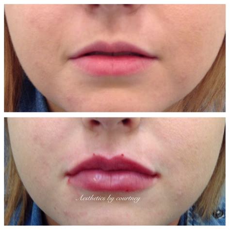 Пин на доске lips