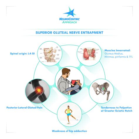 Superior Gluteal Nerve - Dr. Justin Dean