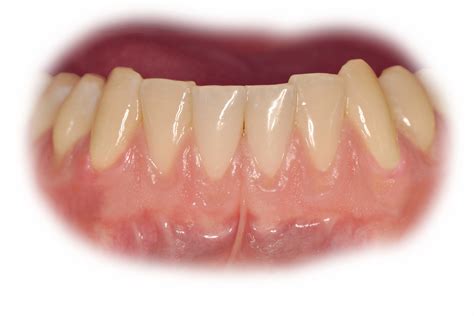 Periodoncia - Clinica Dr. Javier Garcia Barbero