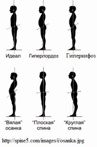 Оценка осанки - Методы исследования клиента