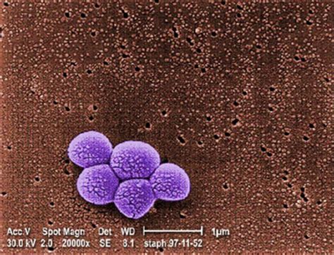 Staphylococcus Aureus