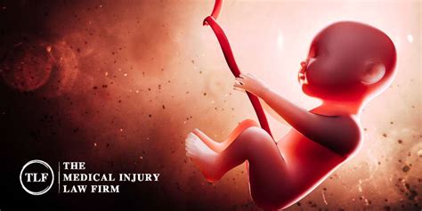 Marginal Cord Insertion - Causes, Risks, and Related Birth Injuries