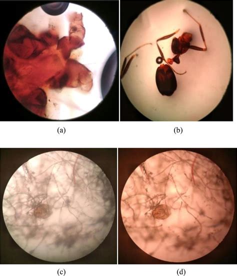 Dust Mite Microscope