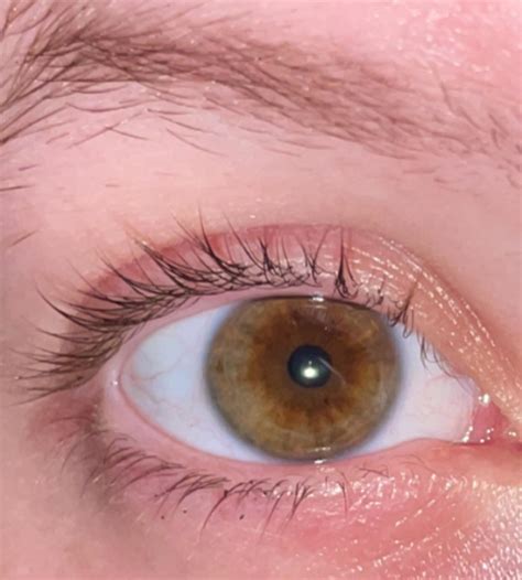 central heterochromia  brown eye reyes