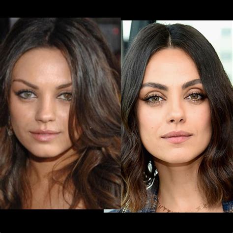 What caused this extreme upper eyelid exposure increase? She’s only 39 ...