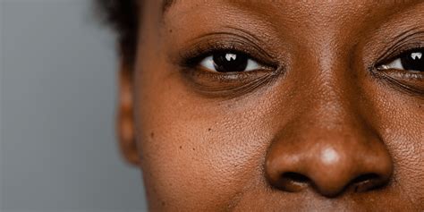 How to Treat a Pimple In Your Nose, According to Derms