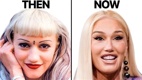 Gwen Stefani NEW FACE | Plastic Surgery Analysis - YouTube