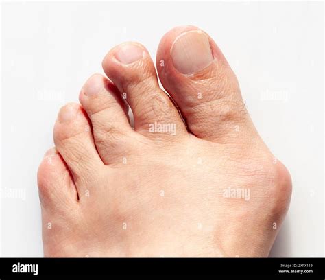 human foot anatomy  res stock photography  images alamy