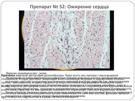 Микропрепараты. Патологическая анатомия - презентация онлайн