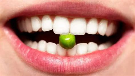 Los mejores alimentos para conservar tus dientes sanos - EcoPortal.net