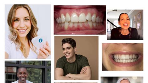 Case Studies - Patients