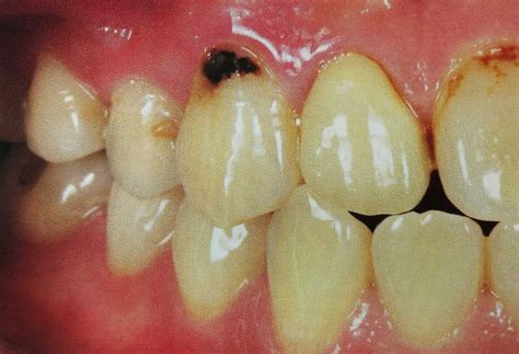 ppja
