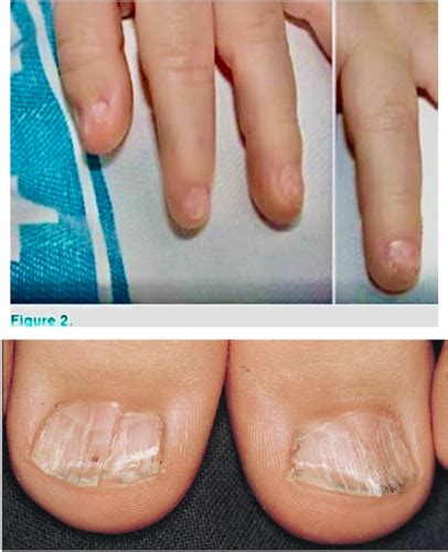 normal abnormal growth  children flashcards quizlet