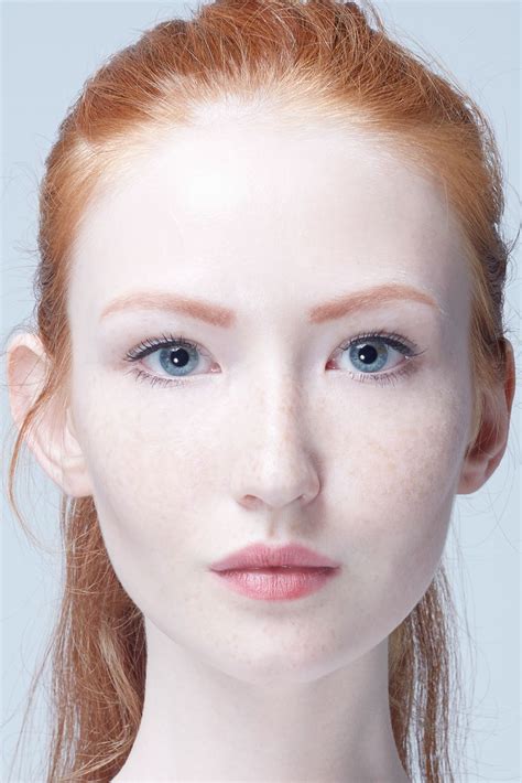 Fair Skin And Freckles