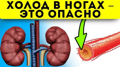 Мерзнут ноги? Вот 10 самых опасных причин почему это происходит ...