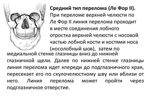 Переломы костей лицевого черепа - презентация онлайн
