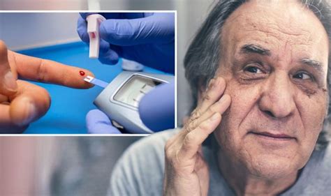 Diabetes type 2: Symptoms include scaly skin, skin tags and yellow ...