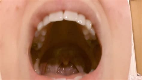 Uvula