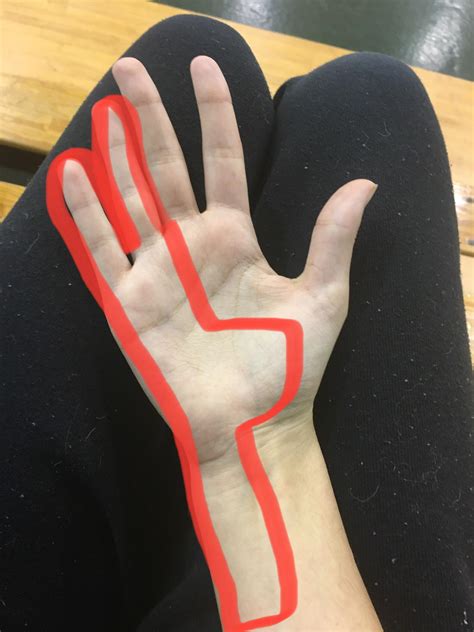 what can cause slight tingling here on my right hand and arm? it’s been