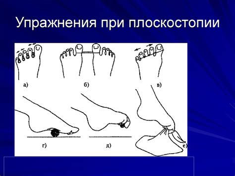 ЛФК при плоскостопии - презентация онлайн