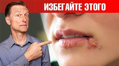 Правильное питание при герпесе. полезные и опасные продукты при герпесе